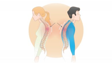 قوز کمر چند سانت قد را کوتاه میکند؟