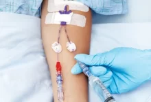 تفاوت برانول و آنژیوکت