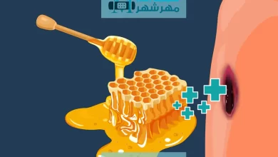 معجزه عسل برای درمان زخم؛ واقعیت یا شایعه؟