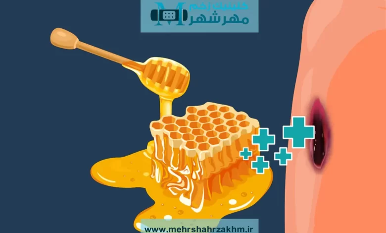 معجزه عسل برای درمان زخم؛ واقعیت یا شایعه؟
