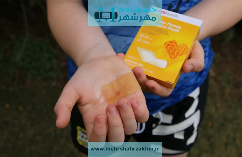 معجزه عسل برای درمان زخم؛ واقعیت یا شایعه؟