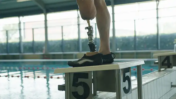 کاشت پای مصنوعی