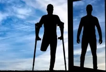 کاشت پای مصنوعی پیشرفته