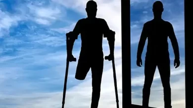 کاشت پای مصنوعی پیشرفته